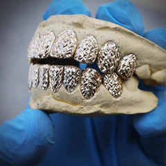 Custom Fully Iced Out Grillz That Dazzle